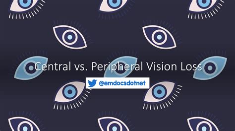 Emergency Medicine Educationcentral Vs Peripheral Vision