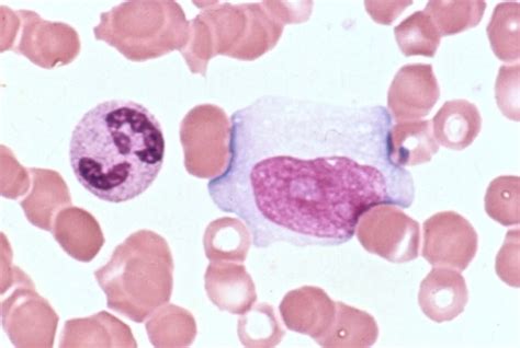 How to identify lymphocytes in a blood smear | Pathology Student