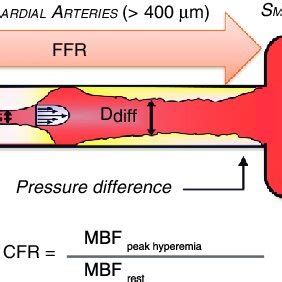 Conceptual Schematic Of Coronary Flow Reserve CFR Measurements CFR