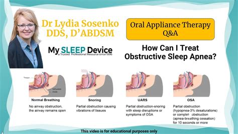 How Can I Treat Obstructive Sleep Apnea Youtube