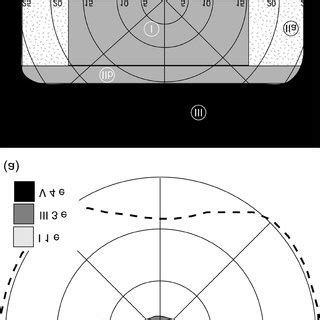 Binocular Visual Field With A Sony Glasstron Plm A Measured With