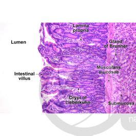 Man Small Intestine Duodenum Transverse Section X Small