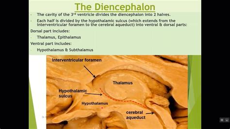 ANATOMY OF EPITHALAMUS - YouTube