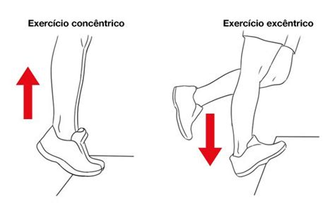 Exercícios Excêntricos Para O Tendão De Aquiles Tendinopatia