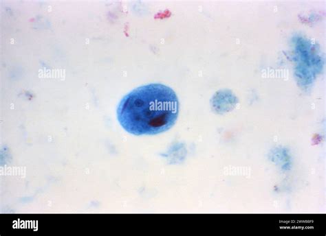 This Photomicrograph Of A Trichrome Stained Specimen Revealed A Mature Entamoeba Coli Cyst Stock