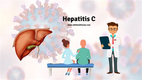 Hepatitis C: Stages, Symptoms and Treatment | wiki Health News