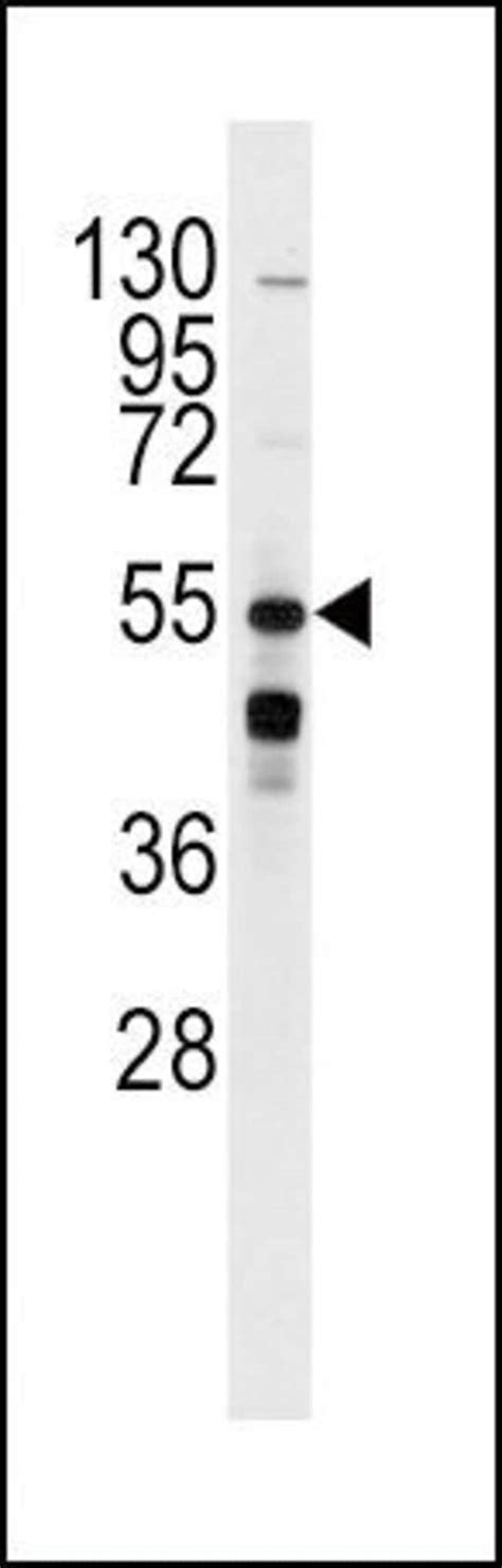 Beta Adrenergic Receptor Polyclonal Antibody Invitrogen L