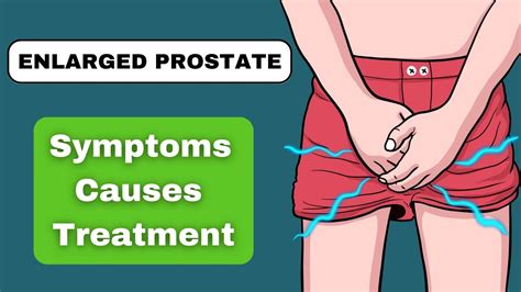 Enlarged Prostate Bph Signs Symptoms And Treatment Every Man