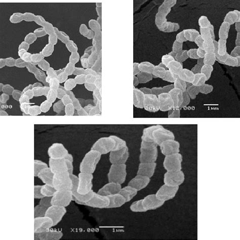 Scanning Electron Micrograph Showing The Spore Chain Morphology And