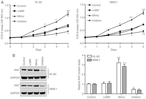 Microrna‑21 Promotes Proliferation In Acute Myeloid Leukemia By Targeting Krüppel‑like Factor 5