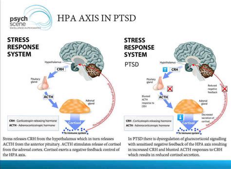 Management And Neurobiology Of PTSD