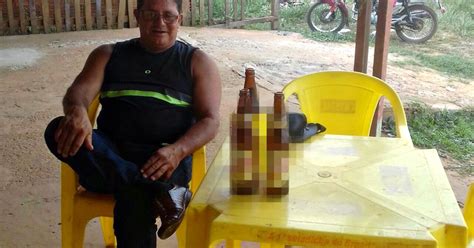 G Policial Tem Bala Alojada No Pulm O Ap S Ser Alvejado Em Bar No