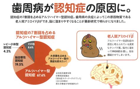 歯周病の治療＆予防で認知症予防 医療法人社団徳治会 松下歯科医院 熊本県八代市