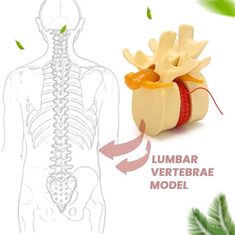 Modello Di Vertebre Lombari Colonna Vertebrale Anatomica Ernia Del