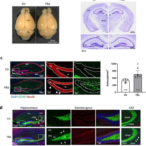 Deletion Of ATR In Purkinje Cells Leads To Locomotor Dysfunction And