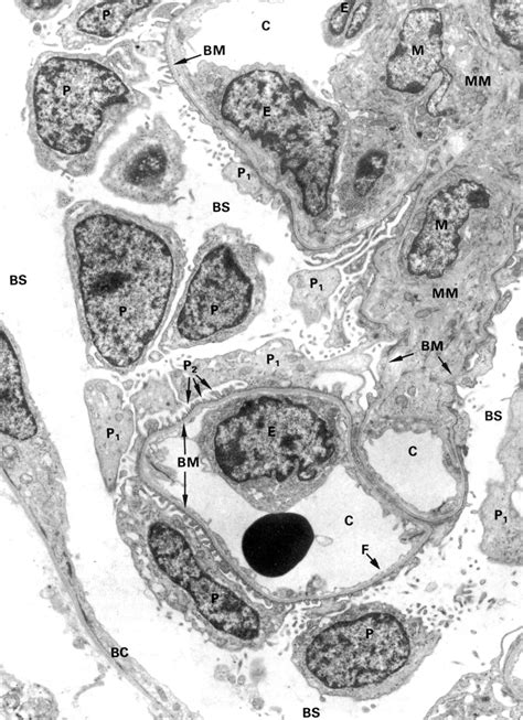 Electron Micrograph