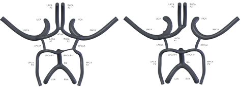2: Variations in the Circle of Willis | Download Scientific Diagram