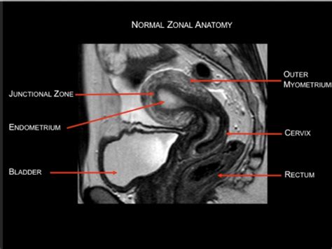 Radiology 2 Common Imaging Pathologies In Reproductive Medication Flashcards Quizlet