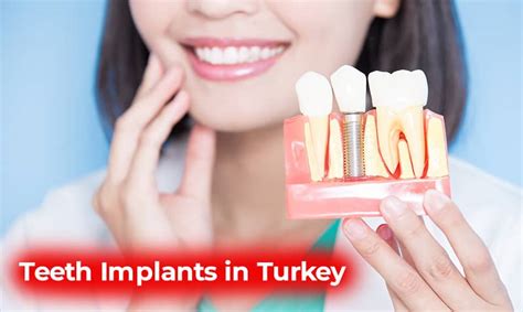 Teeth Implants in Turkey: Fill In The Blanks With The Best