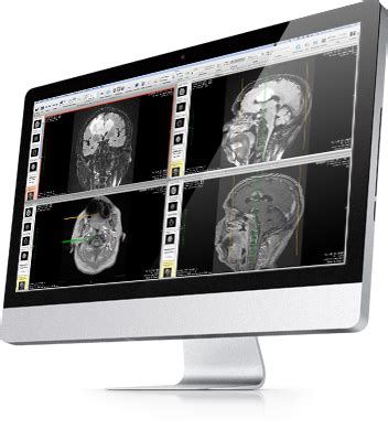 OsiriX DICOM Viewer | Overview