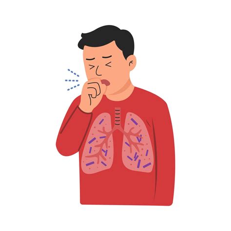 tuberculosis disease. TB infection concept. man cough 67374803 Vector