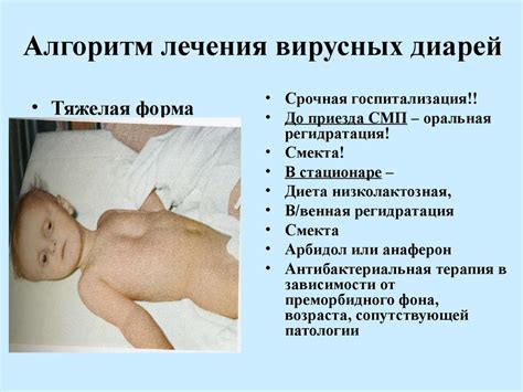 Вирусные диареи - online presentation