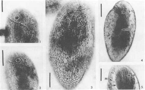 Light microscopy of Chatton-Lwoff stained Zosrerodasys agamalievi. 1.... | Download Scientific ...