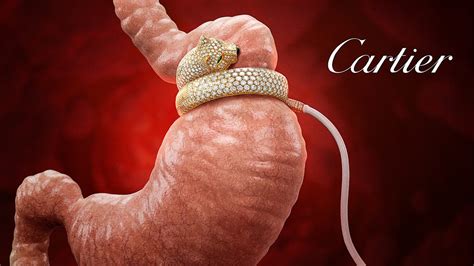 Cartier Introduces New Diamond Encrusted Gastric Lap Band Reportwire