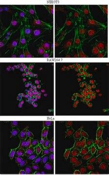 Anti FOXP1 Antibody From Rabbit Purified By Affinity Chromatography