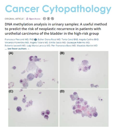 Cancer Cytopathology On Twitter Openaccess A Combined Approach Of