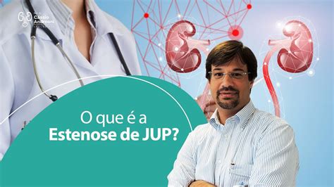 O que é a Estenose de JUP Dr Cássio Andreoni Ribeiro CRM 78546