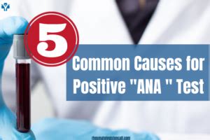 Positive ANA -Know Common 5 causes for a positive ANA Test