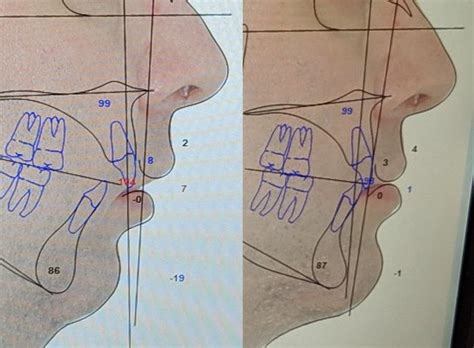 Los Angeles Center For Oral And Maxillofacial Surgery 24 Photos And 66 Reviews 2080 Century Park