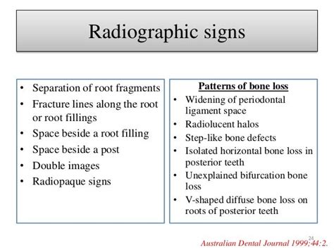 vertical root fracture and it's management .....