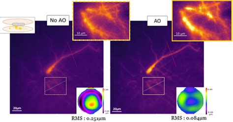 Adaptive optics microscopy direct wavefront sensing |Imagine Optic