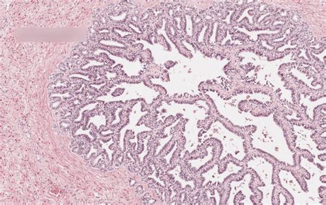 Seminal Vesicle Histology Diagram | Quizlet