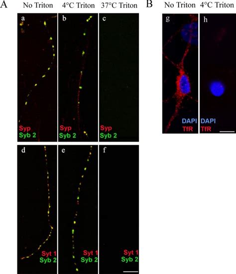 Synaptic vesicle proteins are partly resistant to extraction with... | Download Scientific Diagram