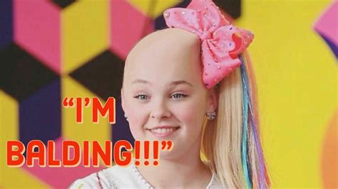 Jojo Siwa Is Going Bald Youtube