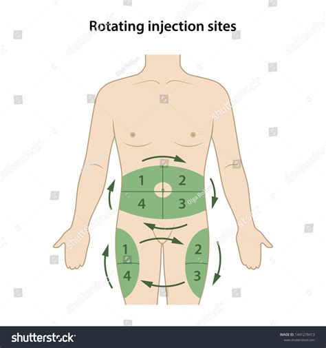 Diabetes Circle Injection Sites Shown On Stock Vector (Royalty Free ...