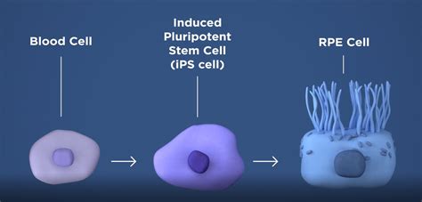 Nih Launches First U S Clinical Trial Of Patient Derived Stem Cell