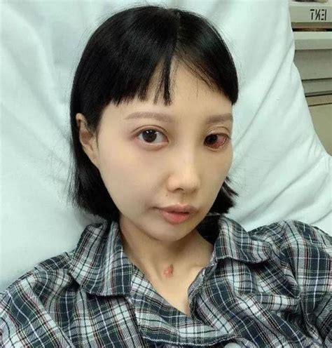 抗癌7年病情反覆！29歲人氣女星再入院手術：服藥出現嚴重副作用 每日頭條