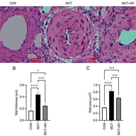 Shikonin Suppresses Pulmonary Vascular Remodeling Of Mct Induced