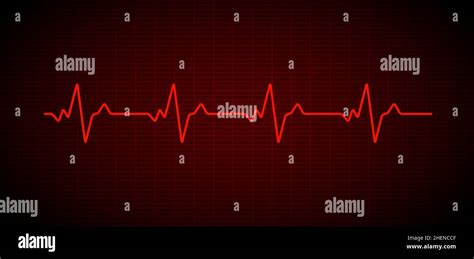 Línea De Onda Del Gráfico Vectorial Del Electrocardiograma Del Latido Del Corazón Monitor De