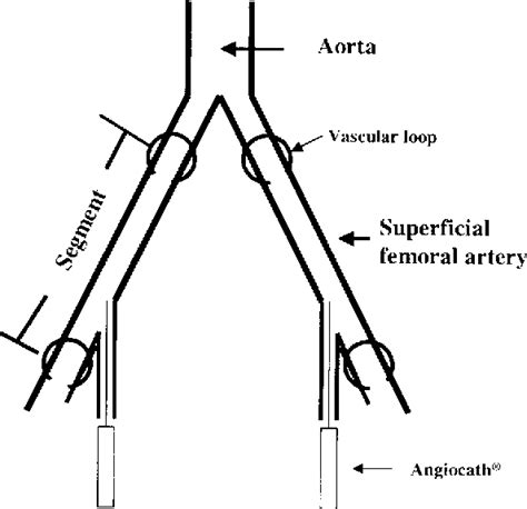 Figure 1 From Arterial Thrombus Dissolution In Vivo Using A Transducer Tipped High Frequency