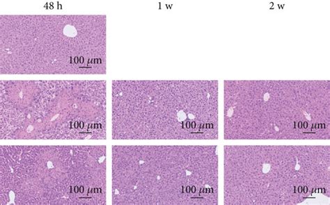 Mscs Protect Against Ccl Induced Acute Liver Injury A Liver Alanine