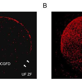 Confocal Scanning Laser Micrographs Of Cortical Granules In Mouse