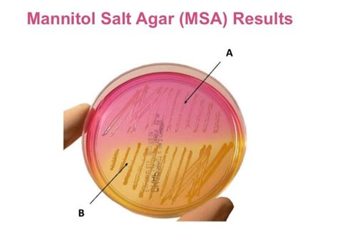 Solved 2. The growth of bacteria on section A of the MSA | Chegg.com