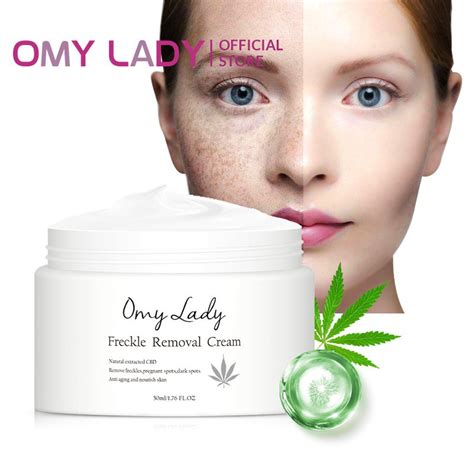 OMY LADY Freckle Removal Cream Remove Freckles Pregnant Spots Dark