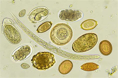 Techion’s Microscope in The Cloud for Parasites - Nanalyze