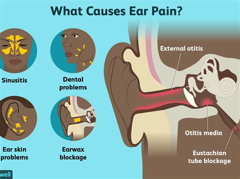 Ears Draining Sore Throat - Best Drain Photos Primagem.Org